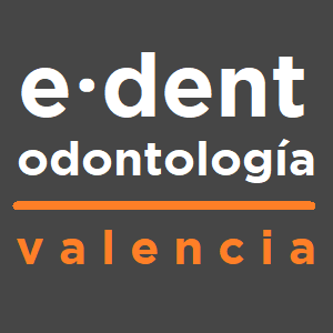 Clinica dental en Valencia